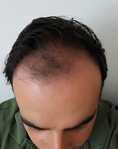 قبل