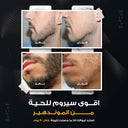 Essential Beard Growth set