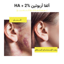 سيروم لتوحيد لون البشرة مع ألفا أربوتين 2% وحمض الهيالورونيك