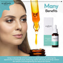 سيروم للتخلص من الحبوب والرؤوس السوداء مع 5% زنك و 1% PCA ونياسيناميد