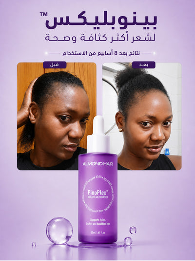 Advanced Hair Growth System for women