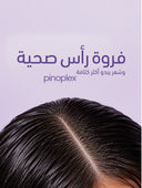 نظام متطور لنمو الشعر للنساء