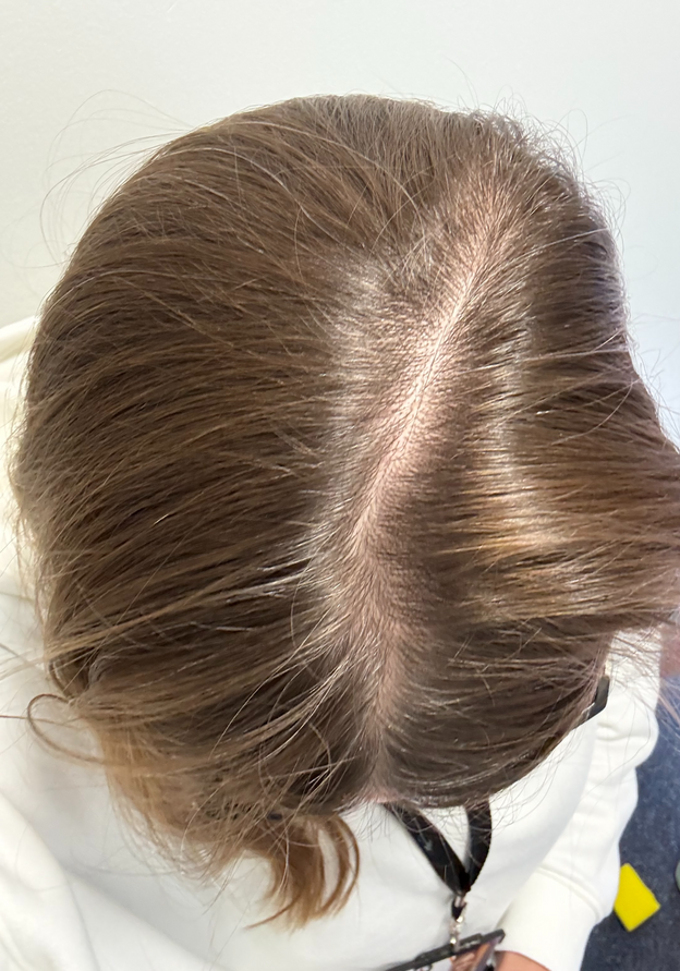 3 MONTHS