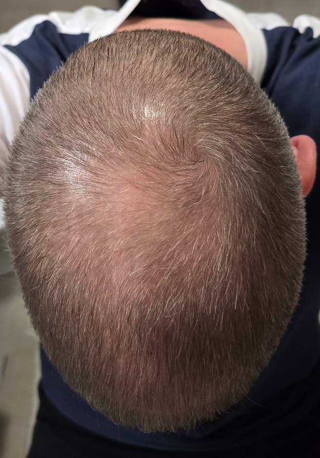 3 MONTHS