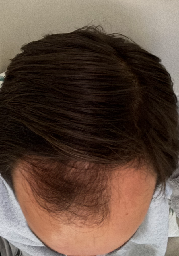 3 MONTHS