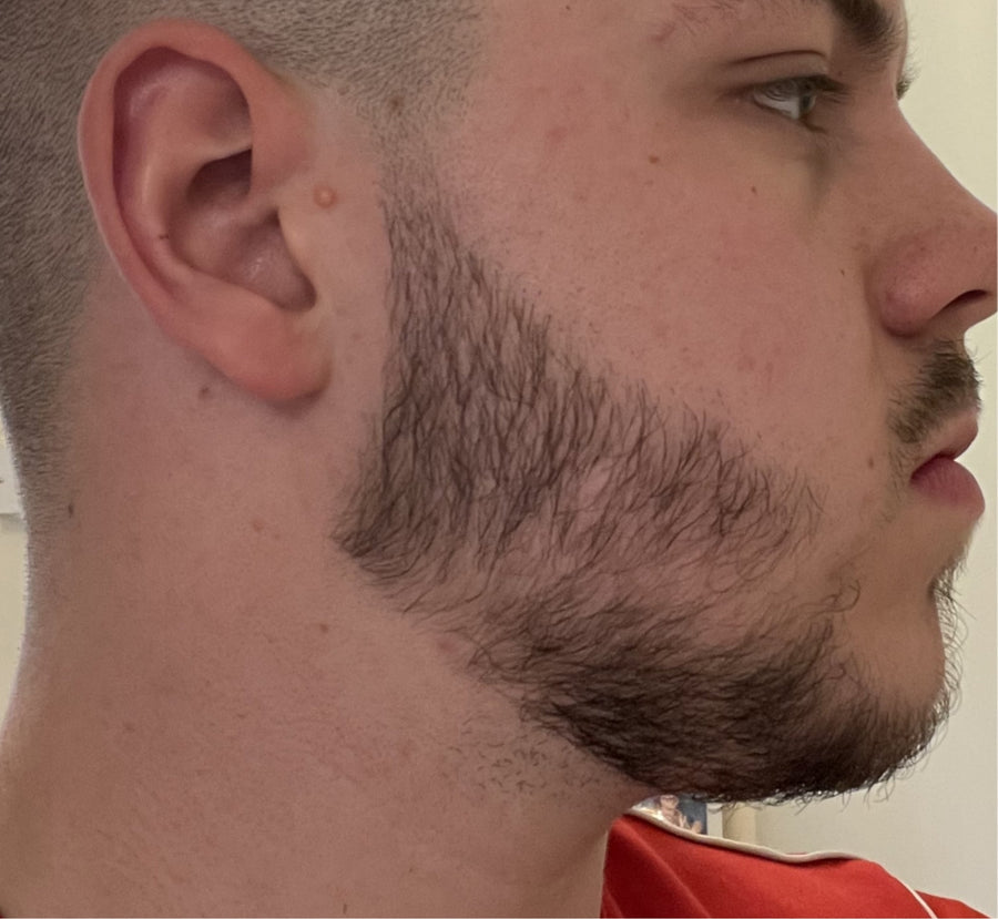 3 MONTHS