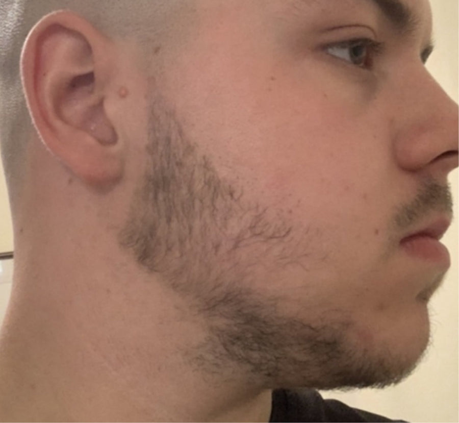 Before