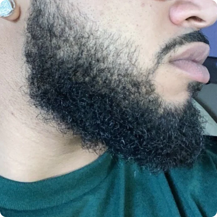 3 MONTHS