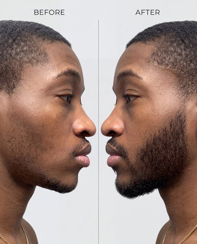Advanced Beard Growth & Care Set