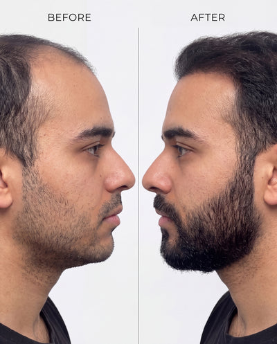 RootBioTec™ Hair Serum for Men