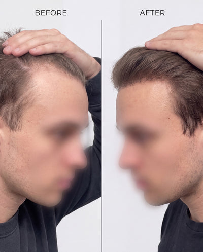RootBioTec™ Hair Serum for Men