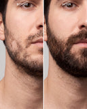 AvenaPlex™ Beard Serum