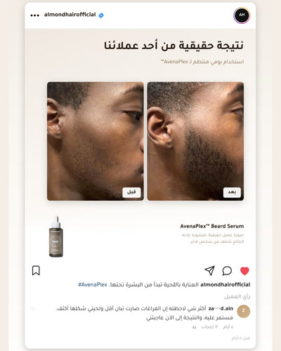 AvenaPlex™ — real customer result, before and after