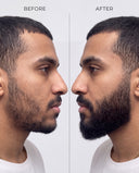Advanced Beard Growth & Care Set