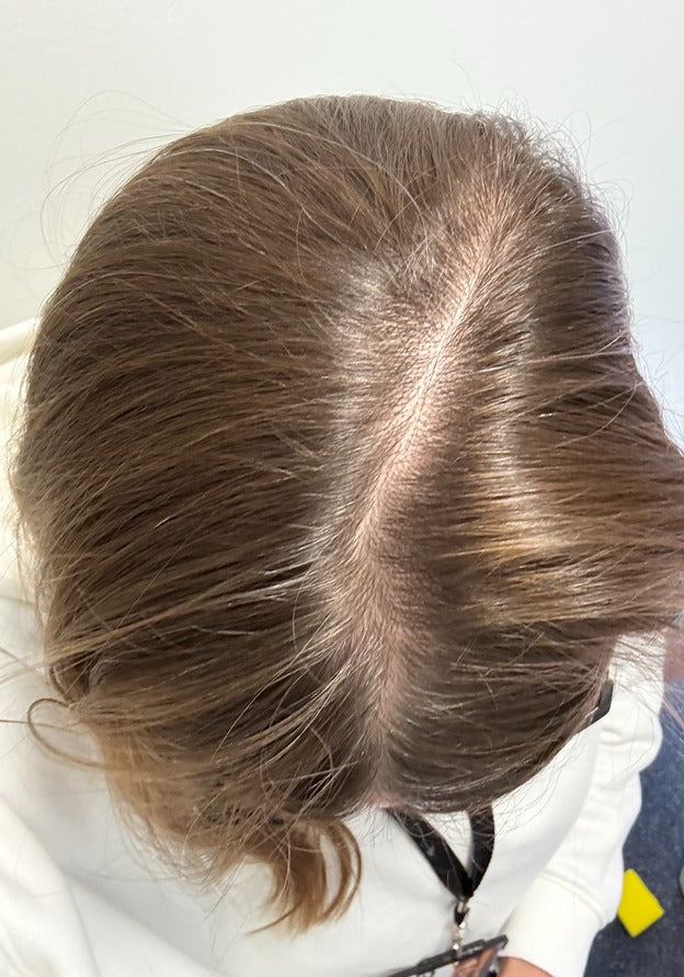 Helen after using PinoPlex - fuller-looking parting
