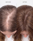 PinoPlex™ Hair Serum for Women