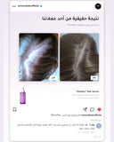 PinoPlex™ — real customer result, before and after