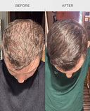 RootBioTec™ Hair Serum for Men