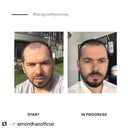 سيروم الموند هير بلس مع كابيليا لونجا للعناية بالشعر للرجال