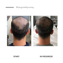 مجموعة مستلزمات نمو الشعر للرجال من الموند هير مع كابيليا لونجا لتعزيز نمو الشعر وتقوية البصيلات